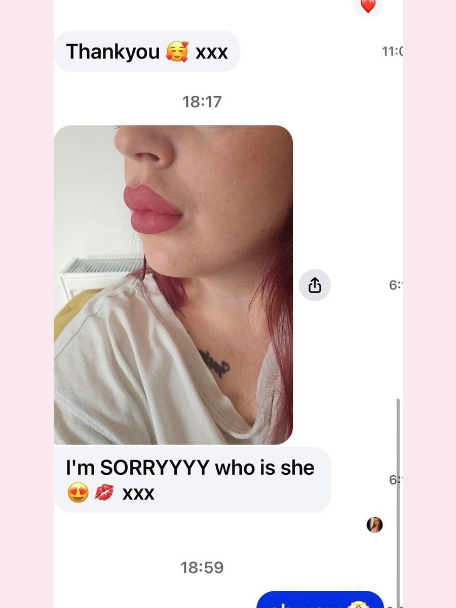 A client's message after a lip filler appointment, thanking the studio