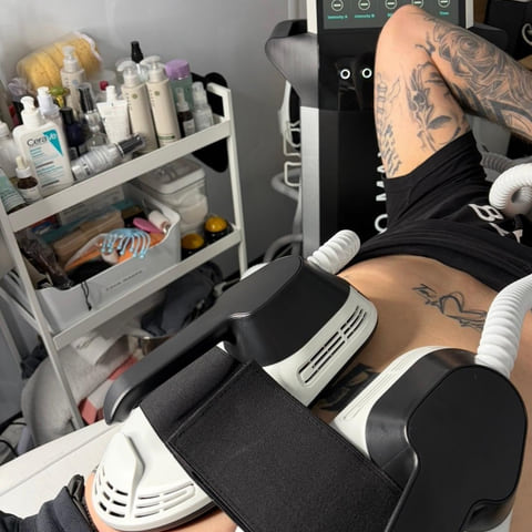 The body sculpt machine's applicators in place on a client's abdomen