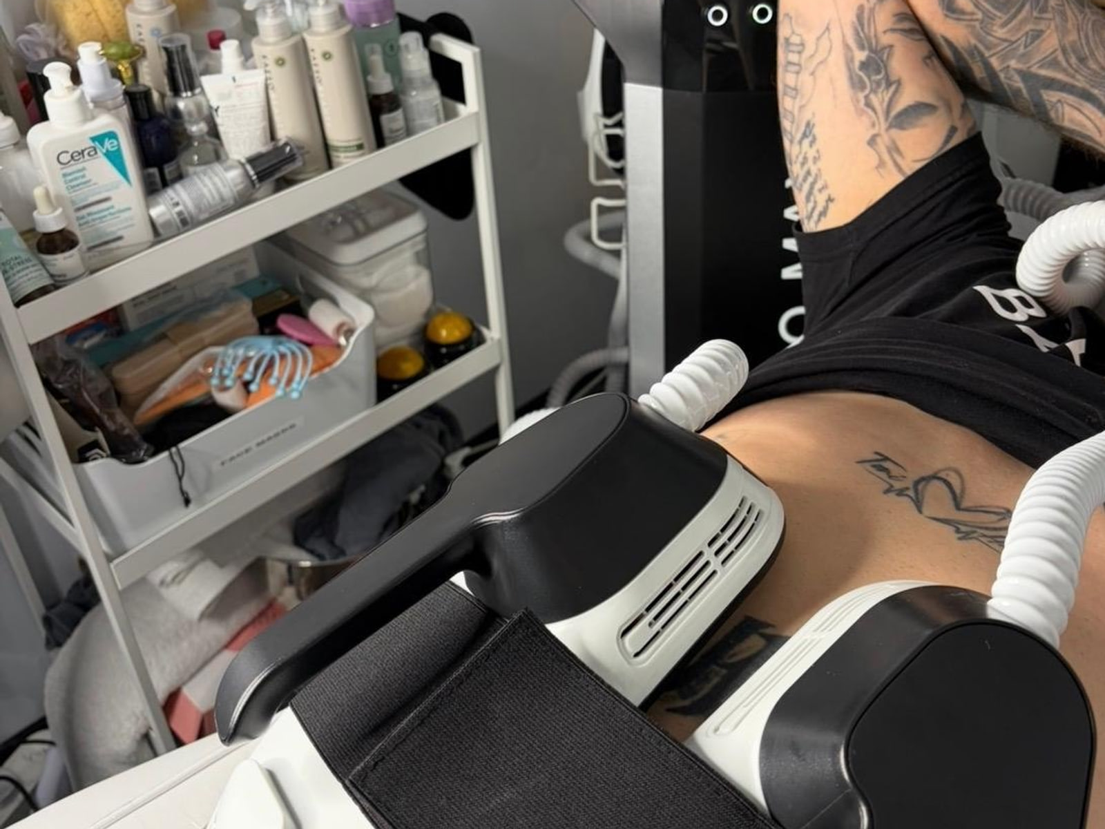 The body sculpt machine's applicators in place on a client's abdomen