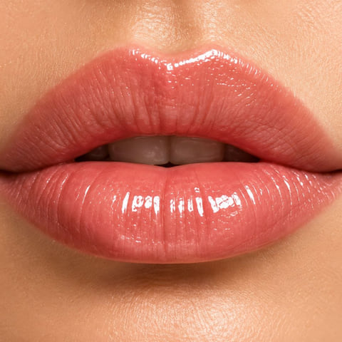 Softly defined lips after a dermal filler appointment